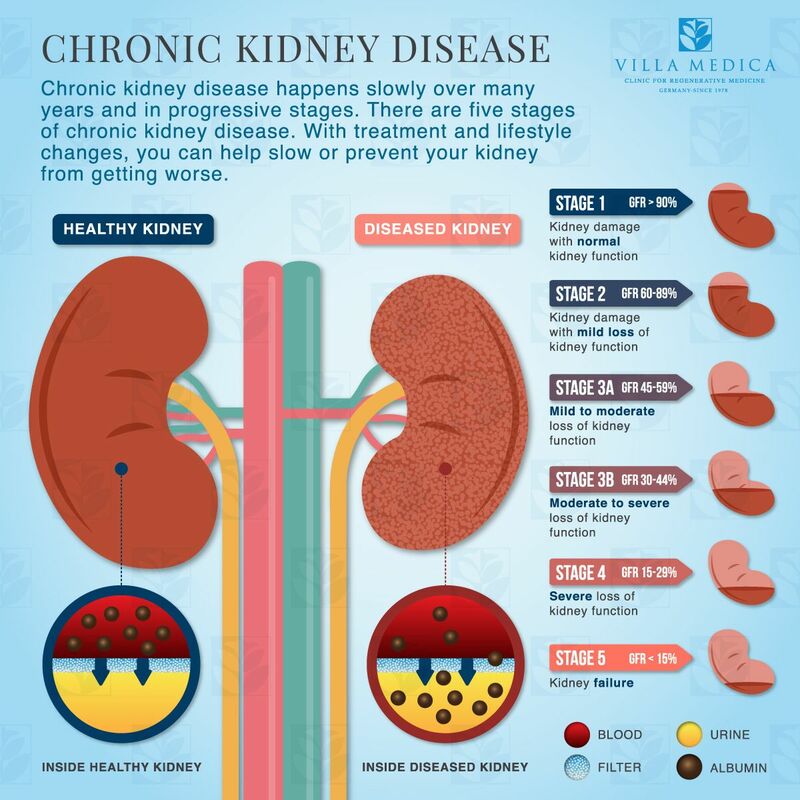 Kidney Failure Treatment Dr Yasir Unani Herbal Hospital Research 