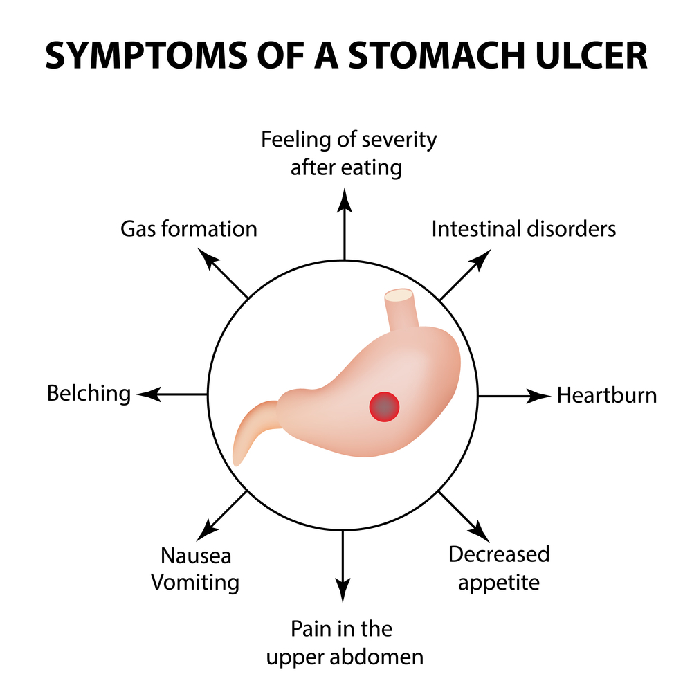 Peptic Ulcer Dr Yasir Unani Herbal Hospital Research Center
